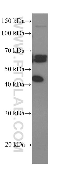 ST2 Mouse anti-Human, Mouse, Porcine, Rat, Clone: 7A2A7, Proteintech 150