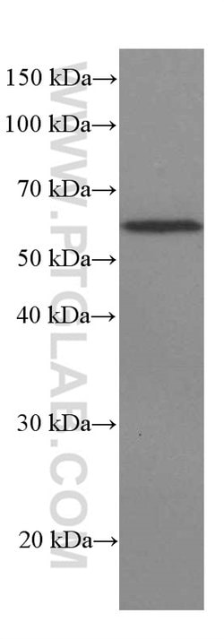 ST2 Mouse anti-Human, Mouse, Porcine, Rat, Clone: 7A2A7, Proteintech 150