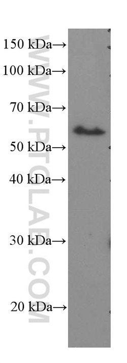 ST2 Mouse anti-Human, Mouse, Porcine, Rat, Clone: 7A2A7, Proteintech 150