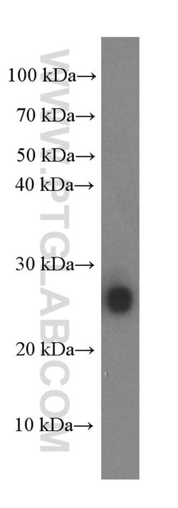 KCNMB4 Mouse anti-Human, Mouse, Clone: 4H7G3, Proteintech 150 &mu;L; Unconjugated:Antibodies,