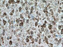 KCNMB4 Mouse anti-Human, Mouse, Clone: 4H7G3, Proteintech 150 &mu;L; Unconjugated:Antibodies,