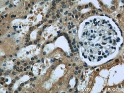 RENALASE Mouse anti-Human, Clone: 3A12F5, Proteintech:Anticorps:Anticorps