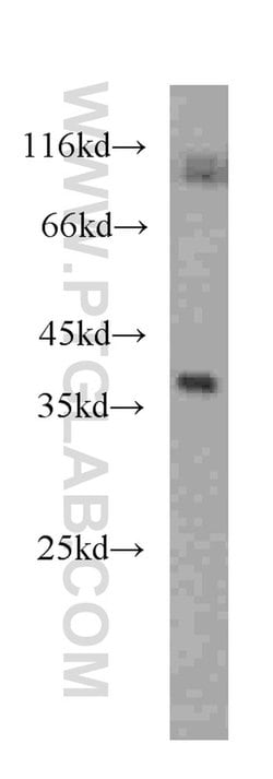 RENALASE Mouse anti-Human, Clone: 3A12F5, Proteintech:Anticorps:Anticorps
