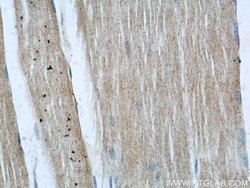 RENALASE Mouse anti-Human, Clone: 3A12F5, Proteintech:Anticorps:Anticorps