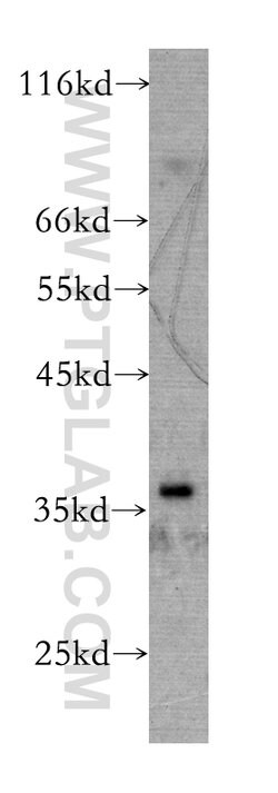 RENALASE Mouse anti-Human, Clone: 3A12F5, Proteintech:Anticorps:Anticorps