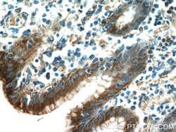 Gastrokine 1 Mouse anti-Human, Rat, Clone: 3C10E3, Proteintech:Antibodies:Primary