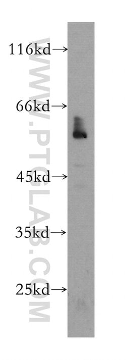 NR1H3 Mouse anti-Human, Rat, Clone: 4A4F7, Proteintech 150 &mu;L; Unconjugated:Antibodies,