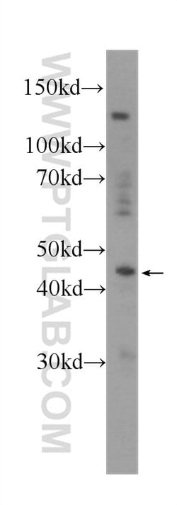 NR1H3 Mouse anti-Human, Rat, Clone: 4A4F7, Proteintech 150 &mu;L; Unconjugated:Antibodies,