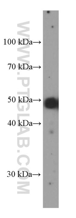 PAX8 Mouse anti-Human, Clone: 4H7B3, Proteintech 20 &mu;L; Unconjugated:Antibodies,