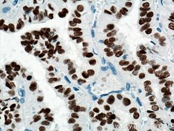 PAX8 Mouse anti-Human, Clone: 4H7B3, Proteintech 20 &mu;L; Unconjugated:Antibodies,