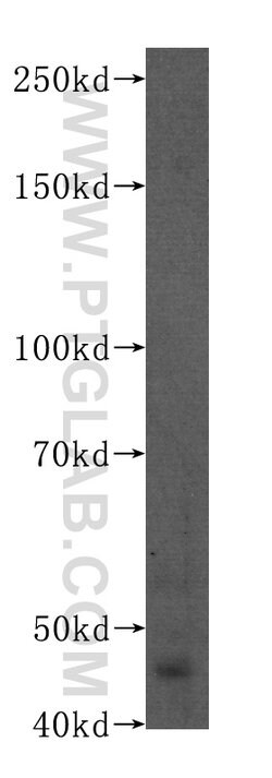 PAX8 Mouse anti-Human, Clone: 4H7B3, Proteintech 20 &mu;L; Unconjugated:Antibodies,
