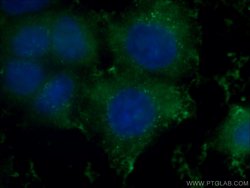 GSTO1 Mouse anti-Human, Mouse, Rat, Clone: 5E1E10, Proteintech:Antibodies:Primary