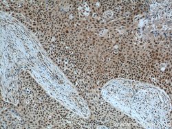 GSTO1 Mouse anti-Human, Mouse, Rat, Clone: 5E1E10, Proteintech:Antibodies:Primary
