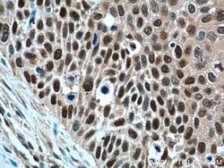GSTO1 Mouse anti-Human, Mouse, Rat, Clone: 5E1E10, Proteintech:Antibodies:Primary