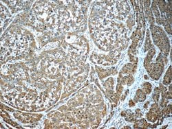 GSTO1 Mouse anti-Human, Mouse, Rat, Clone: 5E1E10, Proteintech:Antibodies:Primary