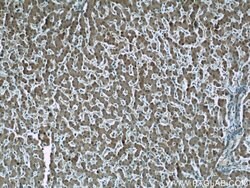 GSTO1 Mouse anti-Human, Mouse, Rat, Clone: 5E1E10, Proteintech:Antibodies:Primary