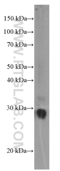 GSTO1 Mouse anti-Human, Mouse, Rat, Clone: 5E1E10, Proteintech:Antibodies:Primary