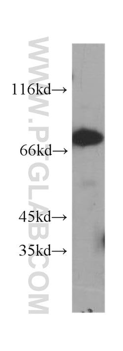ABCD1 Mouse anti-Human, Clone: 1H8E5, Proteintech:Antibodies:Primary Antibodies
