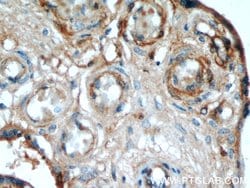 AMOT Mouse anti-Human, Porcine, Clone: 3H7B3, Proteintech:Antibodies:Primary