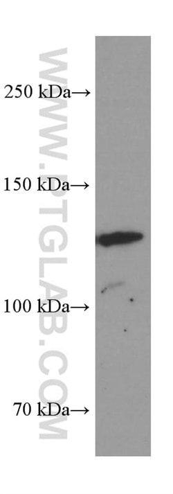 AMOT Mouse anti-Human, Porcine, Clone: 3H7B3, Proteintech:Antibodies:Primary