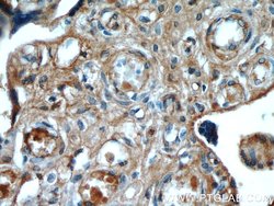 AMOT Mouse anti-Human, Porcine, Clone: 3H7B3, Proteintech:Antibodies:Primary