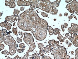 AMOT Mouse anti-Human, Porcine, Clone: 3H7B3, Proteintech:Antibodies:Primary