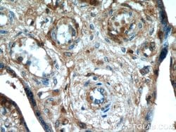 AMOT Mouse anti-Human, Porcine, Clone: 3H7B3, Proteintech:Antibodies:Primary
