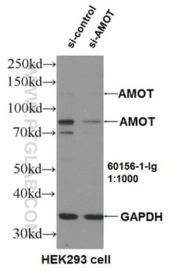 AMOT Mouse anti-Human, Porcine, Clone: 3H7B3, Proteintech:Antibodies:Primary