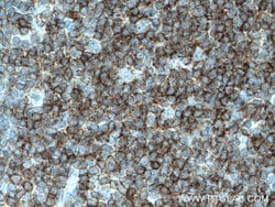 LCK Mouse anti-Human, Porcine, Rat, Clone: 2D10C2, Proteintech:Antibodies:Primary