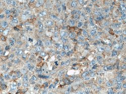 LCK Mouse anti-Human, Porcine, Rat, Clone: 2D10C2, Proteintech:Antibodies:Primary