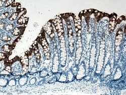 Cytokeratin 20 Mouse anti-Human, Clone: 4D10A4, Proteintech 150 &mu;L;