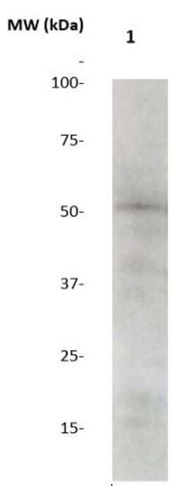 GSK-3b Polyclonal Antibody, Abbomax 100 &mu;g; Unconjugated:Antibodies,