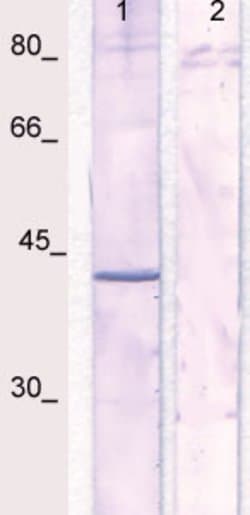 Phospho-IkBa (NFkB1A) (Ser32, Ser36) Polyclonal Antibody, Abbomax 100 &mu;g | Buy Online | Abbomax Inc | Fisher Scientific