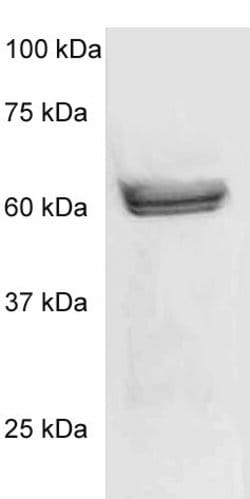 Phospho-p56-LCK (LSK) (Tyr505) Polyclonal Antibody, Abbomax 100 &mu;g;