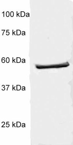 p56-LCK (LSK) Polyclonal Antibody, Abbomax 100 &mu;g | Buy Online | Abbomax Inc | Fisher Scientific