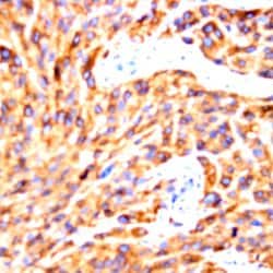 FLT1 Peptide Polyclonal Antibody, Abbomax 100 &mu;g; Unconjugated:Antibodies,