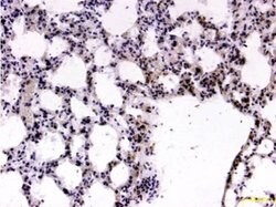 FOXP2 Polyclonal Antibody, Abbomax 100 &mu;g; Unconjugated:Antibodies,