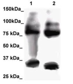 FOXP2 Polyclonal Antibody, Abbomax 100 &mu;g; Unconjugated:Antibodies,