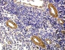 FOXP3 Polyclonal Antibody, Abbomax 100 &mu;g; Unconjugated:Antibodies,
