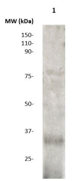 RCAS1 Polyclonal Antibody, Abbomax 100 &mu;g | Buy Online | Abbomax Inc | Fisher Scientific