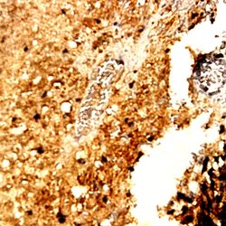MMP-13 Polyclonal Antibody, Abbomax 100 &mu;g; Unconjugated:Antibodies,