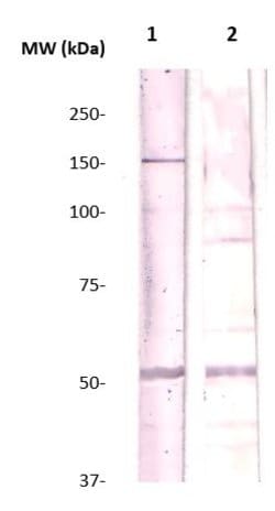 Rho Kinase/ROCKII Polyclonal Antibody, Abbomax 100 &mu;g; Unconjugated:Antibodies,