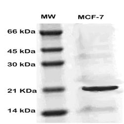 MIG 7 Polyclonal Antibody, Abbomax 100 &mu;g; Unconjugated:Antibodies,