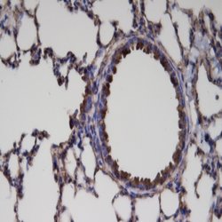 ER81 Polyclonal Antibody, Abbomax 100 &mu;g | Buy Online | Abbomax Inc | Fisher Scientific