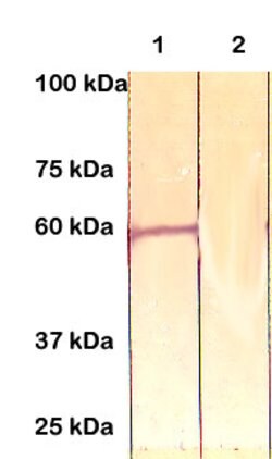 ER81 Polyclonal Antibody, Abbomax 100 &mu;g | Buy Online | Abbomax Inc | Fisher Scientific