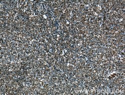 UBC9 Mouse anti-Human, Mouse, Rat, Clone: 4A10B11, Proteintech 150 &mu;L;