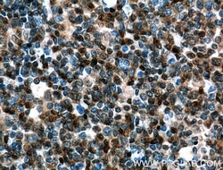 UBC9 Mouse anti-Human, Mouse, Rat, Clone: 4A10B11, Proteintech 150 &mu;L;