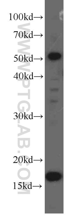 UBC9 Mouse anti-Human, Mouse, Rat, Clone: 4A10B11, Proteintech 150 &mu;L;