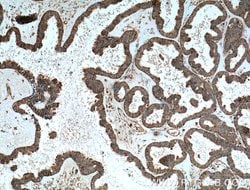 TRIP6 Mouse anti-Human, Mouse, Clone: 5D8C7, Proteintech 150 &mu;L | Buy Online | Proteintech Group Inc | Fisher Scientific