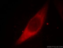 Galectin-3 Mouse anti-Human, Mouse, Rat, Clone: 1C1B2, Proteintech 150 &mu;L | Buy Online | Proteintech Group Inc | Fisher Scientific